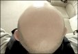 Bald head selfie TZ70 P1030608.JPG
