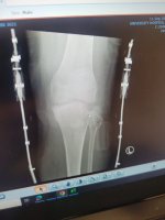 knee.jpg