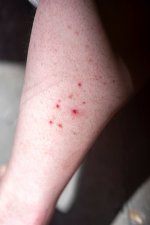 Horse flies.JPG Horse flies.JPG