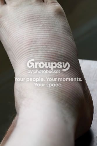 ANKLE.jpg