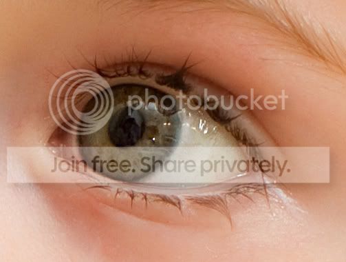 eye2.jpg